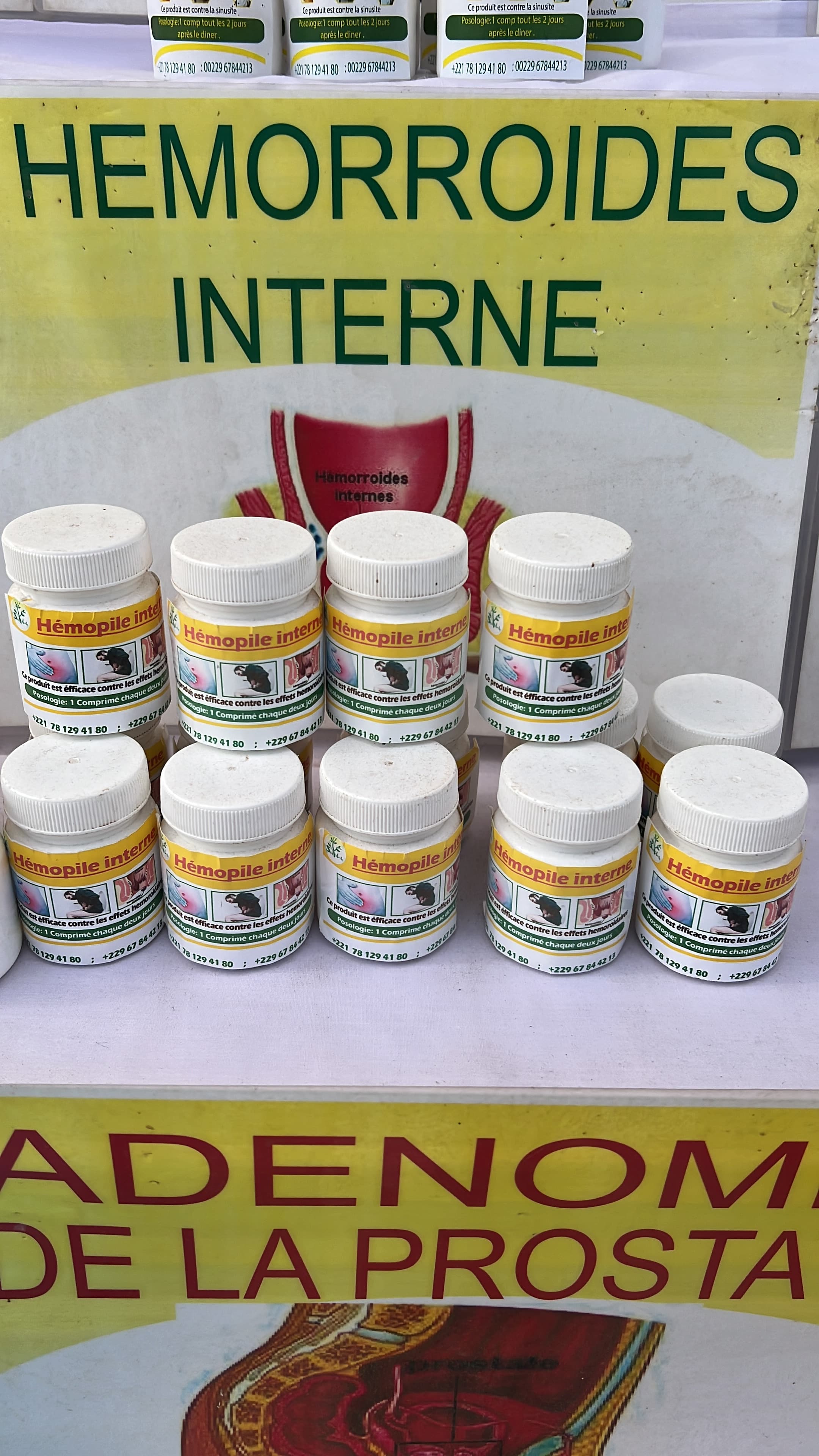 Hemopile interne