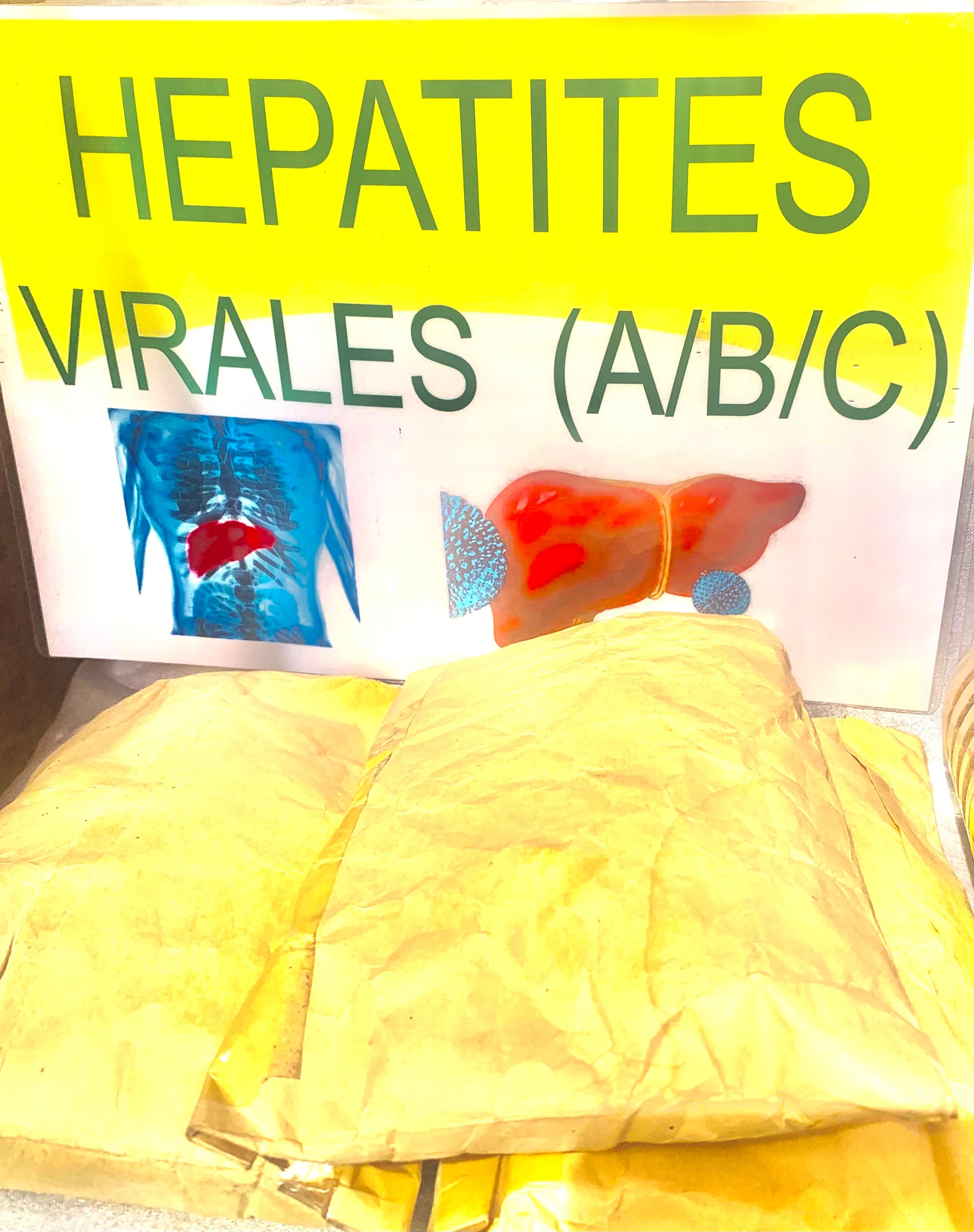 Hépatites