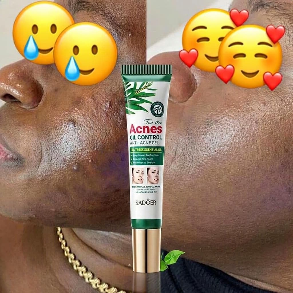 GEL ANTI-ACNÉ AU TEA TREE